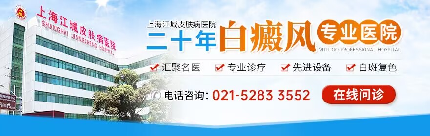 上海江城皮肤病医院-上海白癜风医院-上海治疗白癜风哪家好